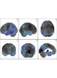 Программное обеспечение для обработки изображений головного мозга mim neuro™ оптом