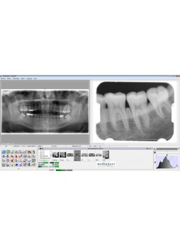 Программное обеспечение для обработки снимков зубов Mediadent