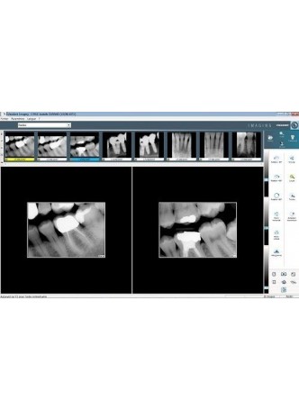 Программное обеспечение для обработки снимков зубов VISIODENT Imaging оптом
