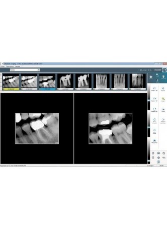 Программное обеспечение для обработки снимков зубов VISIODENT Imaging