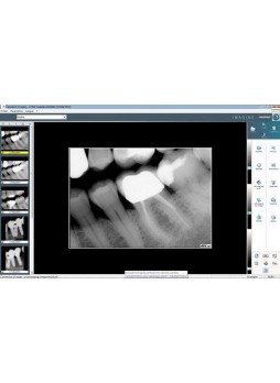 Программное обеспечение для обработки снимков зубов VISIODENT Imaging
