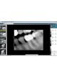 Программное обеспечение для обработки снимков зубов VISIODENT Imaging