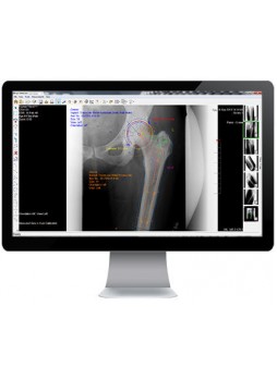Ортопедическое программное обеспечение OrthoCase™