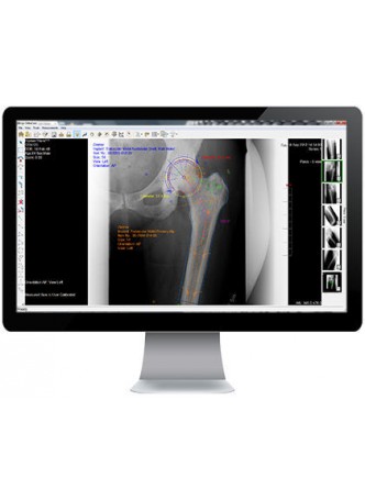 Ортопедическое программное обеспечение OrthoCase™ оптом