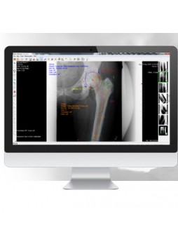 Ортопедическое программное обеспечение OrthoCase™