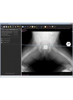 Программное обеспечение для анализа TraumaCad® PEDIATRIC