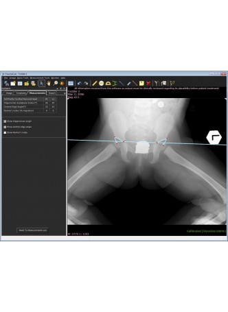 Программное обеспечение для анализа TraumaCad® PEDIATRIC оптом