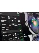 Программное обеспечение для планирования ELEMENTS CRANIAL SRS