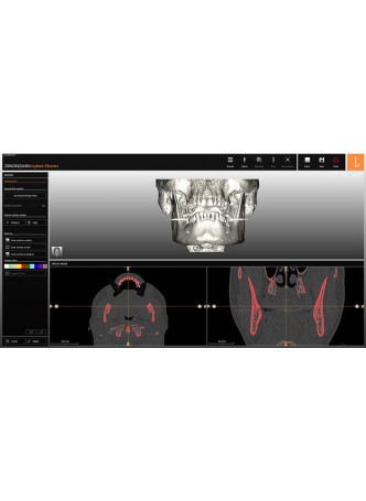 Программное обеспечение для планирования Zirkonzahn.Implant-Planner оптом