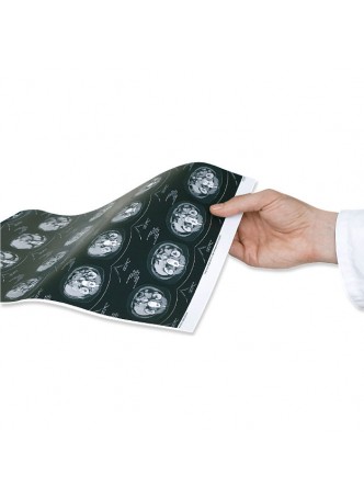Программное обеспечение для медицинских снимков xray-print