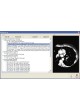 Программное обеспечение DICOM-файла Ultima оптом