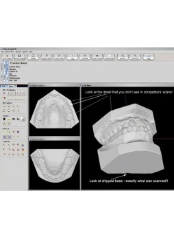 Программное обеспечение для проектирования зубных протезов Ortho Insight 3D Full / Lite