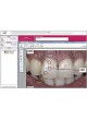 Программное обеспечение для визуализации VITA ShadeAssist, VITA ToothConfigurator