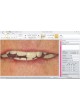 Программное обеспечение для визуализации VITA ShadeAssist, VITA ToothConfigurator