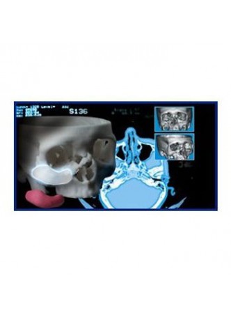 Программное обеспечение эстетическая медицина 3-D Accuscan®