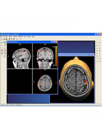 Программное обеспечение для ЭКГ BrainVoyager QX оптом