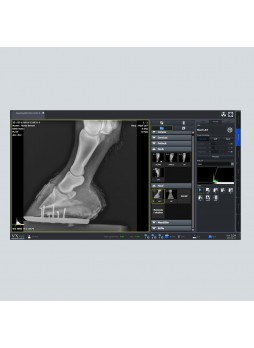 Программное обеспечение рентгенографии VXvue with PureImpact™
