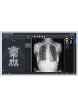 Программное обеспечение рентгенографии VXvue with PureImpact™
