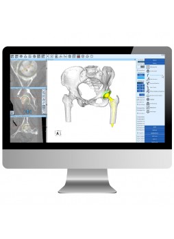 Программное обеспечение TDM ZedHip 3D
