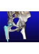 Программное обеспечение TDM mediCAD 3D Hip
