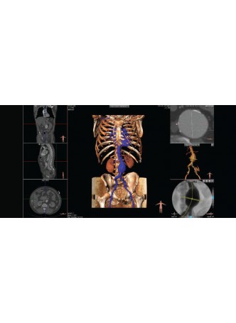Программное обеспечение для кардиологии 3mensio Vascular оптом