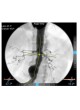 Программное обеспечение для кардиологии 3mensio Vascular оптом
