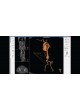 Программное обеспечение для кардиологии 3mensio Vascular оптом