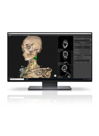 Программное обеспечение TDM Vesalius3D 1 Year Plan оптом
