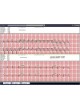 Система управления для анализа INFINITT EKG/ECG