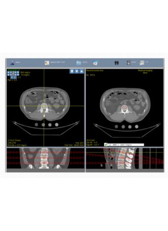 Медицинское веб-приложение N-Vivo™ SPINE BMD оптом
