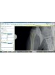 Ветеринарное программное обеспечение OrthoView VET оптом