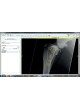 Ветеринарное программное обеспечение OrthoView VET оптом