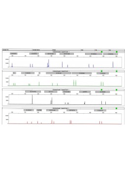 Набор для тестов QF-PCR ChromoQuant Optima STaR/SuperSTaR