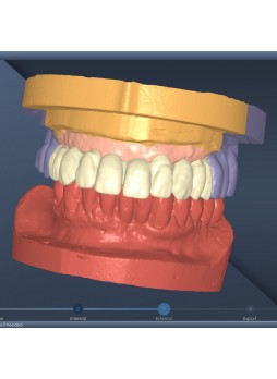 Программное обеспечение для лабораторий DentalCad