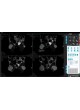 Доклиническое программное обеспечение Preclinical Scan™