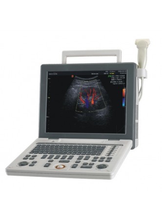 УЗИ-сканер SonoAce R3 Samsung Medison оптом