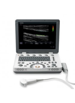 Ультразвуковой сканер MySono U6 Samsung Medison