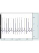 Амплификатор для ЭКГ BN-ECG2 оптом