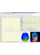 ЭЭГ-система 32 канала Neuron-Spectrum-5