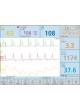Цифровой электрокардиограф CardioScreen 2000