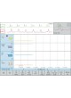 Цифровой электрокардиограф CardioScreen 2000