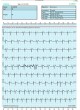 Кардиомонитор Холтера 1 канал SAVVY ECG оптом