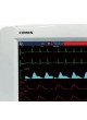 Многопараметрический монитор пациента для ЭКГ C60 оптом