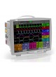 Многопараметрический монитор пациента для ЭКГ FX 3000MD