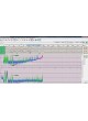 Монитор пациента для EEG CFM оптом