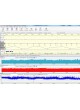Монитор пациента для EEG Neuromonitor оптом