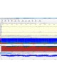 Монитор пациента для EEG Neuromonitor оптом
