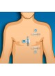 Монитор пациента для ЭКГ BodyGuardian оптом