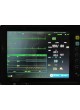 Монитор пациента для ЭКГ PM-12A