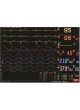 Монитор пациента для ЭКГ M5x, M68, M88 , L1xx, L5xx, XLxx series